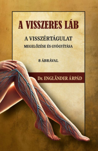 A visszeres láb a visszértágulat megelőzése és gyógyítása