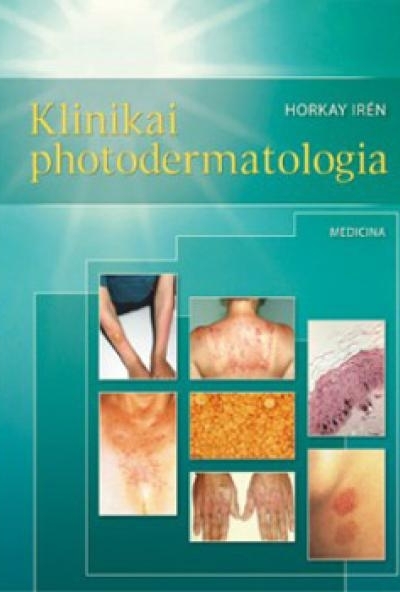 Klinikai photodermatologia